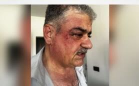Iraq: Lawyer Shuan Mustafa Says He Was Attacked and Threatened by Security Forces