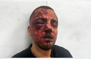 IAPL: Israel: 4 police officers suspected of beating Arab lawyer summoned to pre-indictment hearing